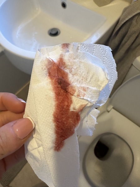 8 weeks - blood when wiping WARNING: PHOTO
