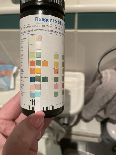 Urine dip sticks *pics included*