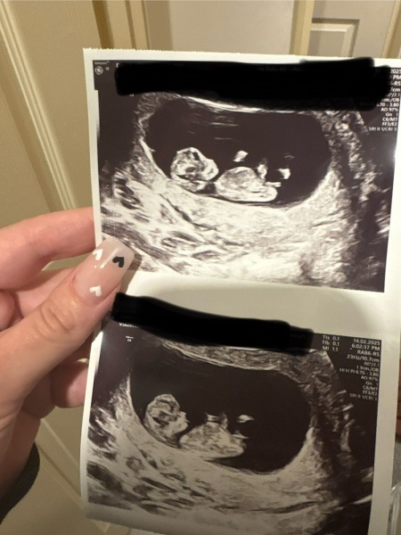 11 week gender guesses