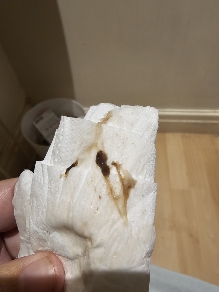 Could this be an early MC?  *Graphic/Trigger Warning*