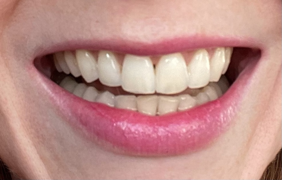 Do my teeth look good?