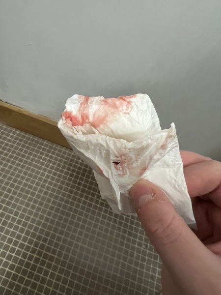 *Graphic Image Warning* Period or implantation edited by MNHQ