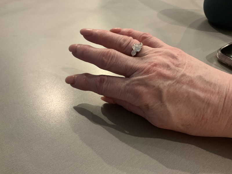 Can I have a look at your engagement rings?