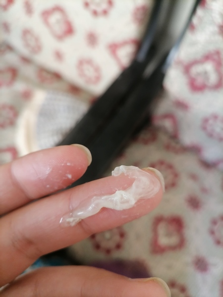 RPOC after miscarriage- what happens next?