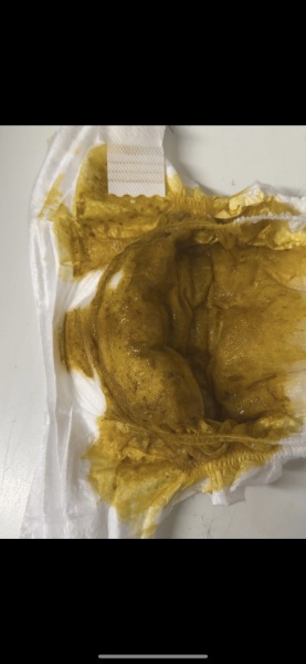 Poo concerns picture attached***