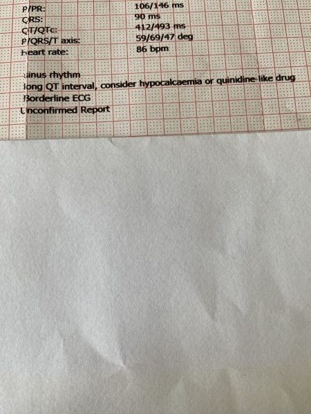 Borderline ECG - long qt interval