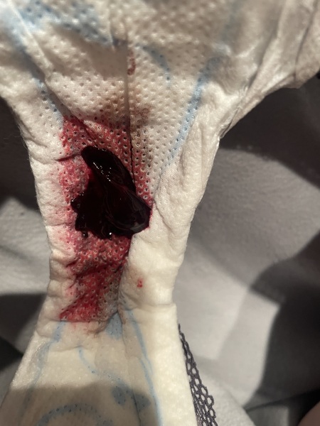 Think I’m miscarrying