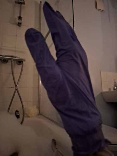 Hand infected (Warning, gross photos)