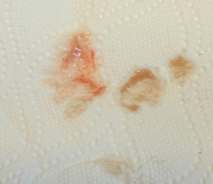CM spotting before Period or Implantation
