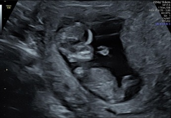 Nub and skull Theory/gender guesses