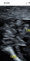 Potty shot guesses