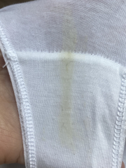 TMI pic in comments. Am I just being hyper anxious?