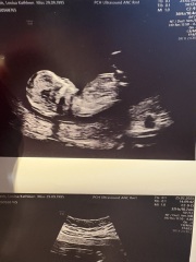 Nub theory!!! So excited!! Guesses please xx