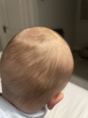 Colour of baby’s hair