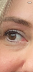 Help! My eyes! Lash lift gone wrong