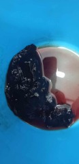 Failed Abortion- Continued pregnancy after finding out..