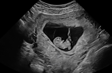 Due in September - over 40 :)