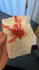 *Graphic Image Warning* Period or implantation edited by MNHQ