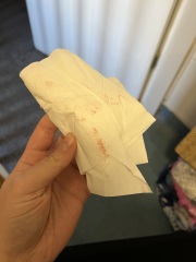 *Graphic Image Warning* Period or implantation edited by MNHQ
