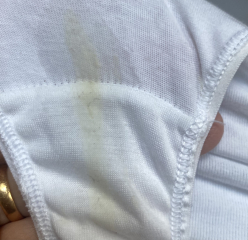 TMI pic in comments. Am I just being hyper anxious?