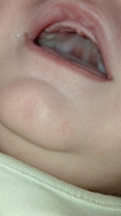 Baby teething 9 weeks old