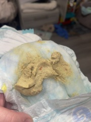 14 month old stool - pics included