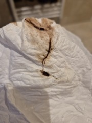 Is this is miscarriage or common discharge? Any help appreciated
