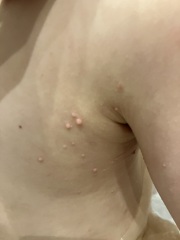 Mystery spots / lumps - anyone recognise it?