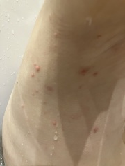 Mystery spots / lumps - anyone recognise it?