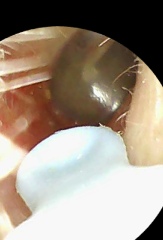 Unwell for a year with dizziness, tinnitus and balance issues, does my ear drum look ok?