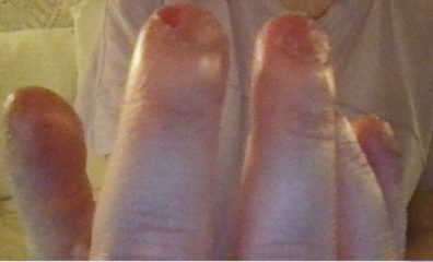 My nails, before and after, advice?