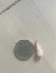 Anyone else's child's teeth come out like this?