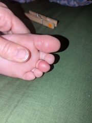 3 yo toes