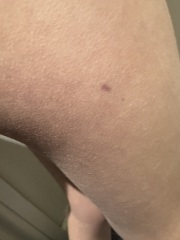 Would you worry over this?