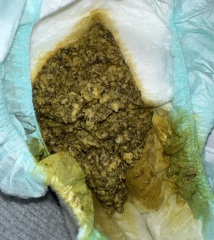 Baby.. Poo- Pictures included.