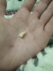Anyone else's child's teeth come out like this?