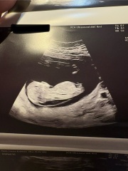 Nub theory!!! So excited!! Guesses please xx