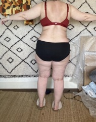 Mounjaro Feb 2025 starters