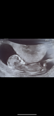 Any gender guesses