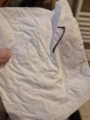 Is this is miscarriage or common discharge? Any help appreciated