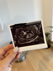 Boy or girl?!