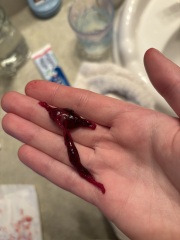 Possible miscarriage? 6 weeks 4 days