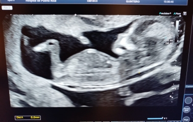 OMG! It's triplets!!!