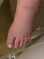 Was anyone else's swelling this bad towards end of pregnancy?  Pics added