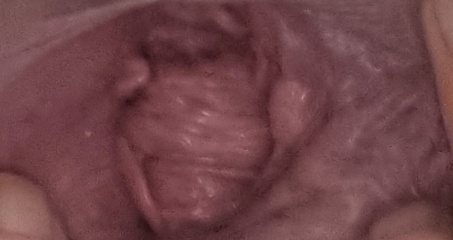 ****WARNING Grapic imagine**** are my bits normal?