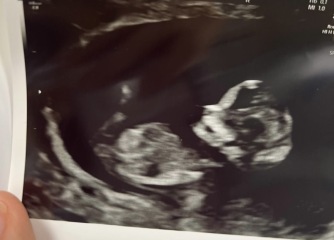 Gender guesses just for fun