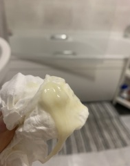 TMI pics! Am i losing my mucus plug already?