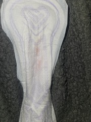 Evaporation line? And implantation bleeding?