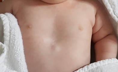Little dip in chest