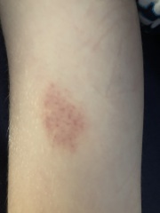 Very worried about my 9 year old